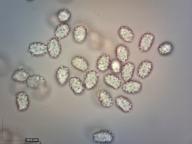 zralé výtrusy (H2O) zralé výtrusy (H2O)