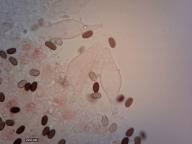 pleurocystidy (kongo červeň NH3)