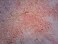 pleurocystidy (kongo červeň NH3)