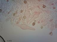 pleurocystidy (kongo červeň NH3)