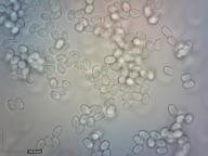 zralé výtrusy H2O zralé výtrusy H2O