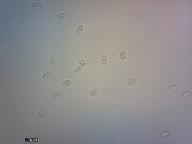 Echinoderma echinaceum 