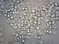 zralé výtrusy H2O zralé výtrusy H2O