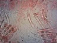 dermatocystidy (kongo červeň NH3)