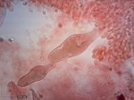 pleurocystidy (kongo červeň NH3)