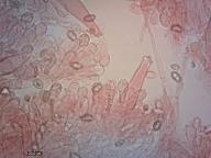 pleurocystidy a bazidie (kongo červeň NH3)