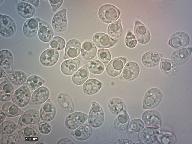 Phaeotremella frondosa 
