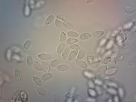 zralé výtrusy H2O zralé výtrusy H2O