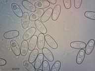 zralé výtrusy H2O zralé výtrusy H2O