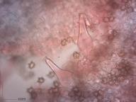 pleurocystidy (kongo červeň NH3)