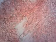 pleurocystidy (kongo červeň NH3)