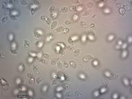 zralé výtrusy H2O zralé výtrusy H2O