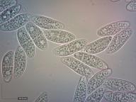 zralé výtrusy H2O zralé výtrusy H2O