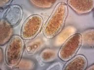 aecidiospory