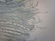 vřecka s výtrusy, parafýzy (bavlníková modř)