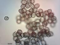 zralé výtrusy (Melzerovo činidlo) zralé výtrusy (Melzerovo činidlo)