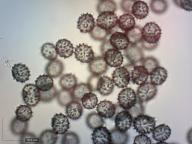 zralé výtrusy (Melzerovo činidlo) zralé výtrusy (Melzerovo činidlo)