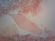 pleurocystidy (kongo červeň NH3)
