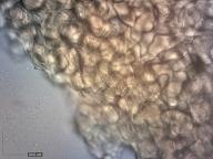 excipulum (Melzerovo činidlo)