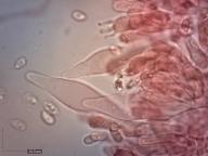 pleurocystidy (kongo červeň NH3)