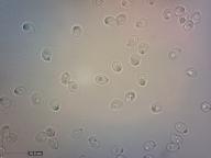 zralé výtrusy H2O zralé výtrusy H2O