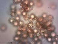 výtrusy (KOH 10%) výtrusy (KOH 10%)