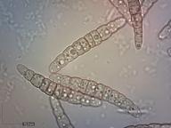 askospory H2O
