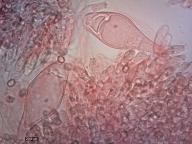 pleurocystidy (kongo červeň NH3)
