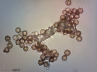 výtrusy (KOH 10%) výtrusy (KOH 10%)