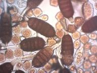 uredospory a teliospory