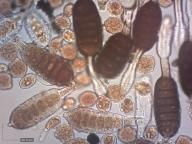 uredospory a teliospory