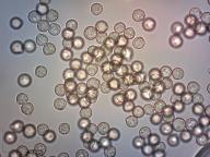 zralé výtrusy H2O zralé výtrusy H2O