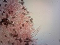 pleurocystidy (kongo červeň NH3)