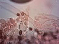 pleurocystidy (kongo červeň NH3)