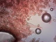 pleurocystidy (kongo červeň NH3)