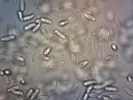 zralé výtrusy H2O zralé výtrusy H2O