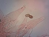 cheilocystidy (kongo červeň NH3)