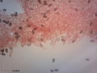 pleurocystidy (kongo červeň NH3)