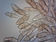 Puccinia malvacearum 