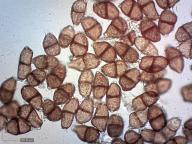 teliospory (H2O)
