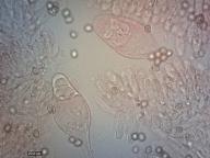 pleurocystidy (kongo červeň NH3)