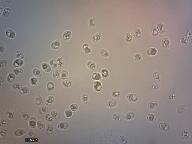 Schizopora radula 