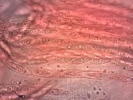 Hypomyces lateritius 