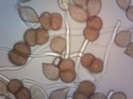 urediospory a teliospory