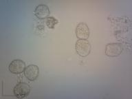Puccinia phragmitis 