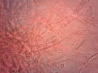 holubinka krvavá holubinka krvavá