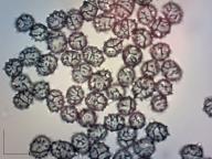 Zralé výtrusy (Melzerovo činidlo) Zralé výtrusy (Melzerovo činidlo)