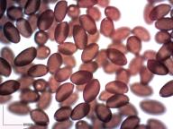 zralé výtrusy (H2O)