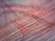 penízovka smrková penízovka smrková