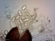 Erysiphe alphitoides 